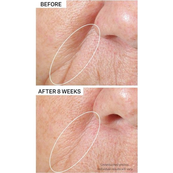 Strivectin Tightening Face Serum - Picture 5 of 14